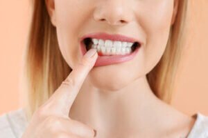  علاج تورم اللثة - التهاب اللثة 