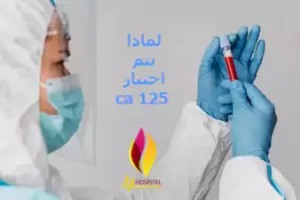 تحليل ca125 , نسبة ca 125 الطبيعية