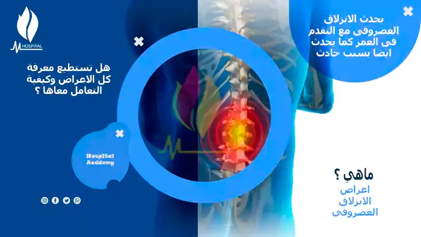 اعراض الانزلاق الغضروفي