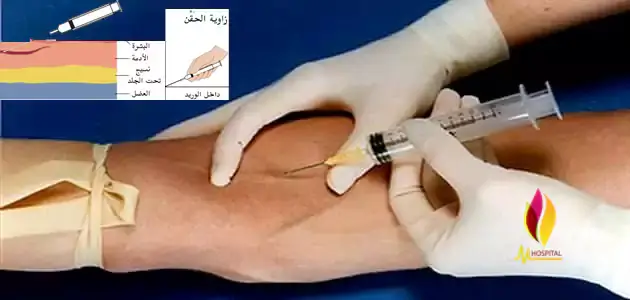 حقن الوريد - هوسبيتال اكادمي