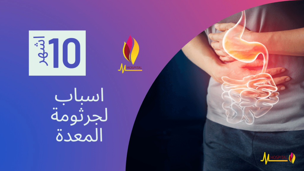 اسباب جرثومة المعدة