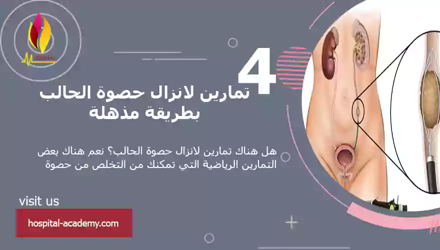 تمارين لانزال حصوة الحالب