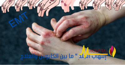 التهاب الجلد