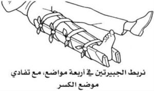 الاسعافات الاولية للسقوط