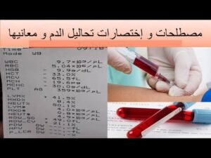 أهم التحاليل الطبية