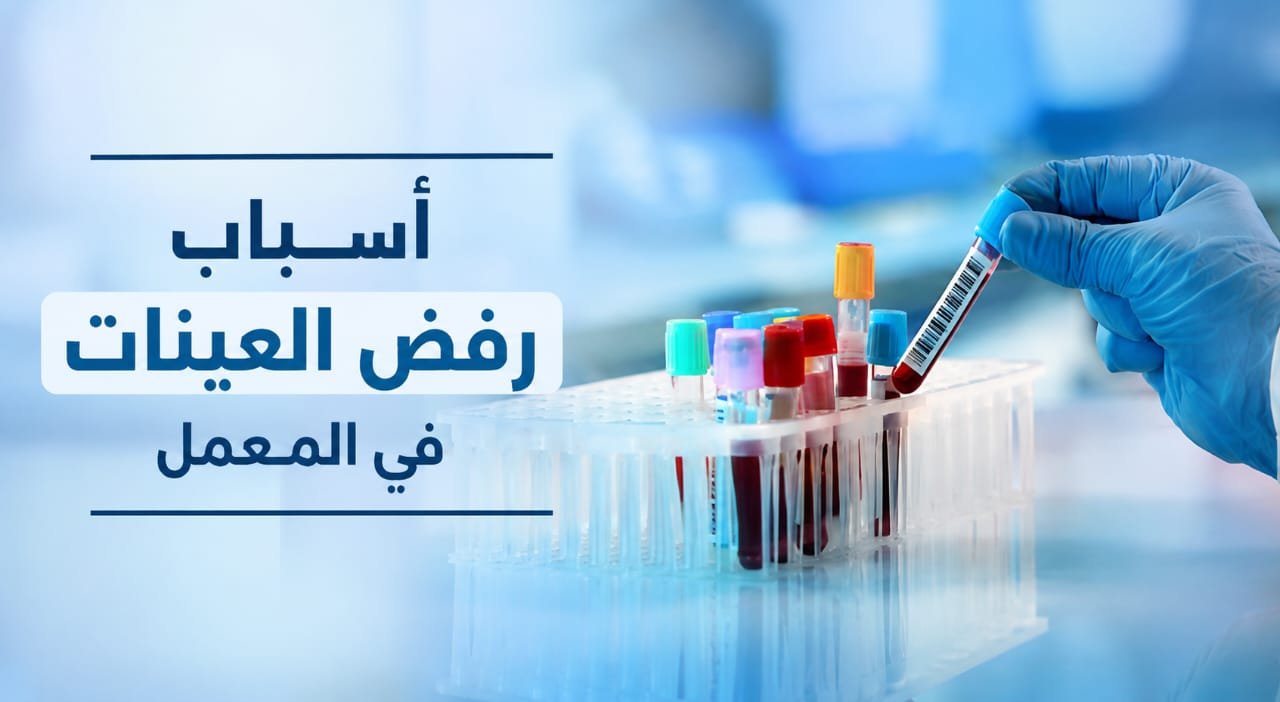 اسباب رفض العينات في المعمل