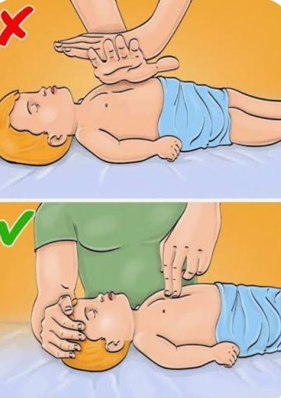 CPR للاطفال الرضع والفرق في عدد الضغطات
