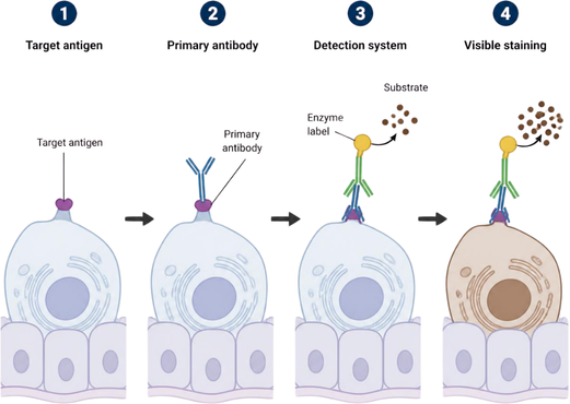 Immunohistochemistry (IHC) in cancer diagnosis