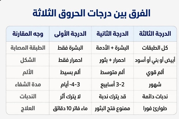 الفرق بين الحرق من الدرجة الاولى والثانية والثالثة